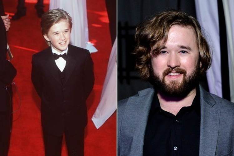 Haley Joel Osment Then And Now