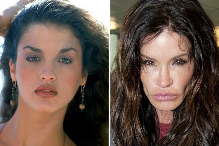 Janice Dickinson Then And Now