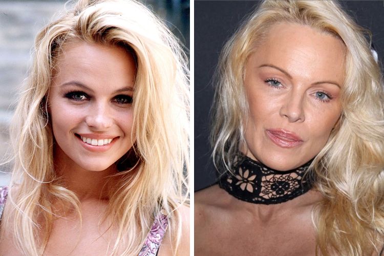 Pamela Anderson Then And Now
