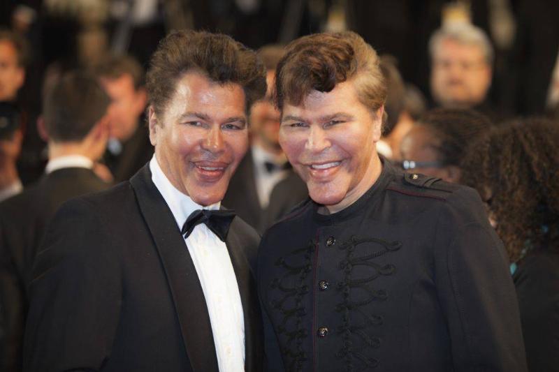 The Twins Have Had Many Surgeries 14