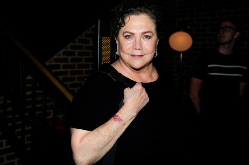 Kathleen Turner Now 8