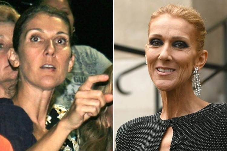 Celine Dion Without Makeup