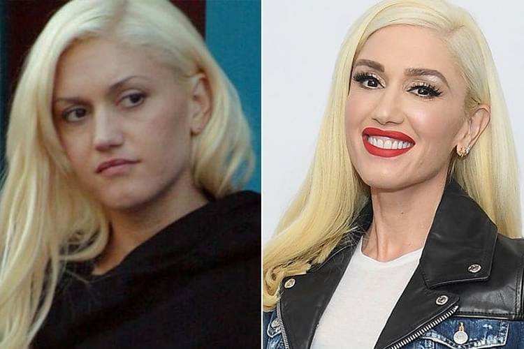 Gwen Stefani Without Makeup