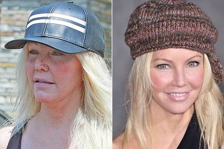 Heather Locklear Without Makeup