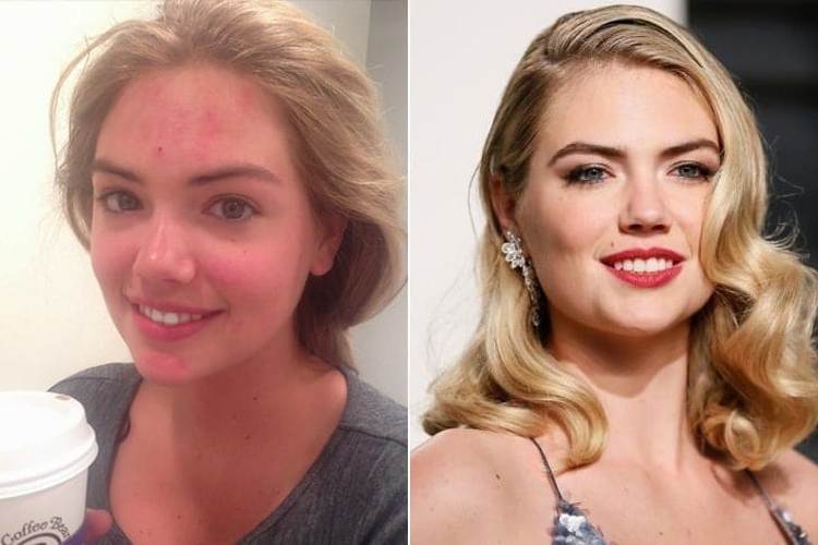 Kate Upton Without Makeup