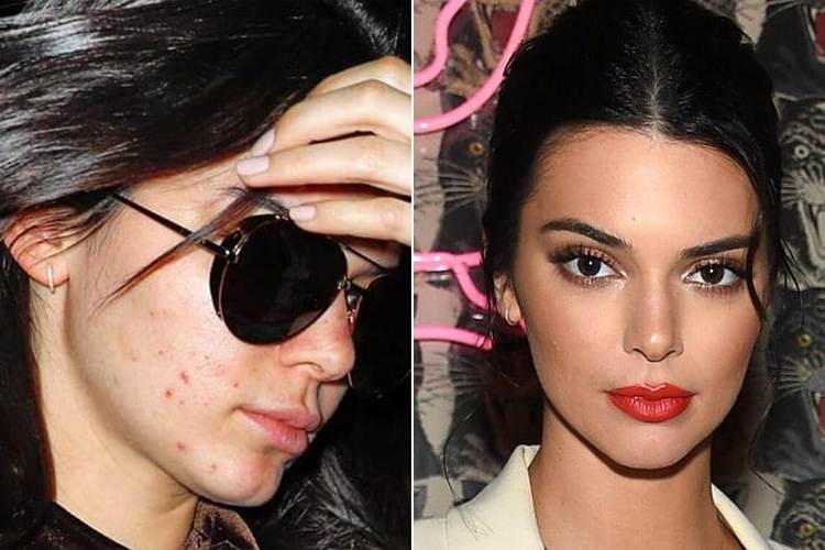 Kendall Jenner Without Makeup
