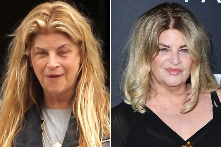 Kirstie Alley Without Makeup