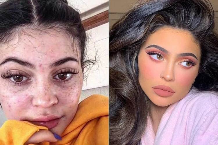 Kylie Jenner Without Makeup